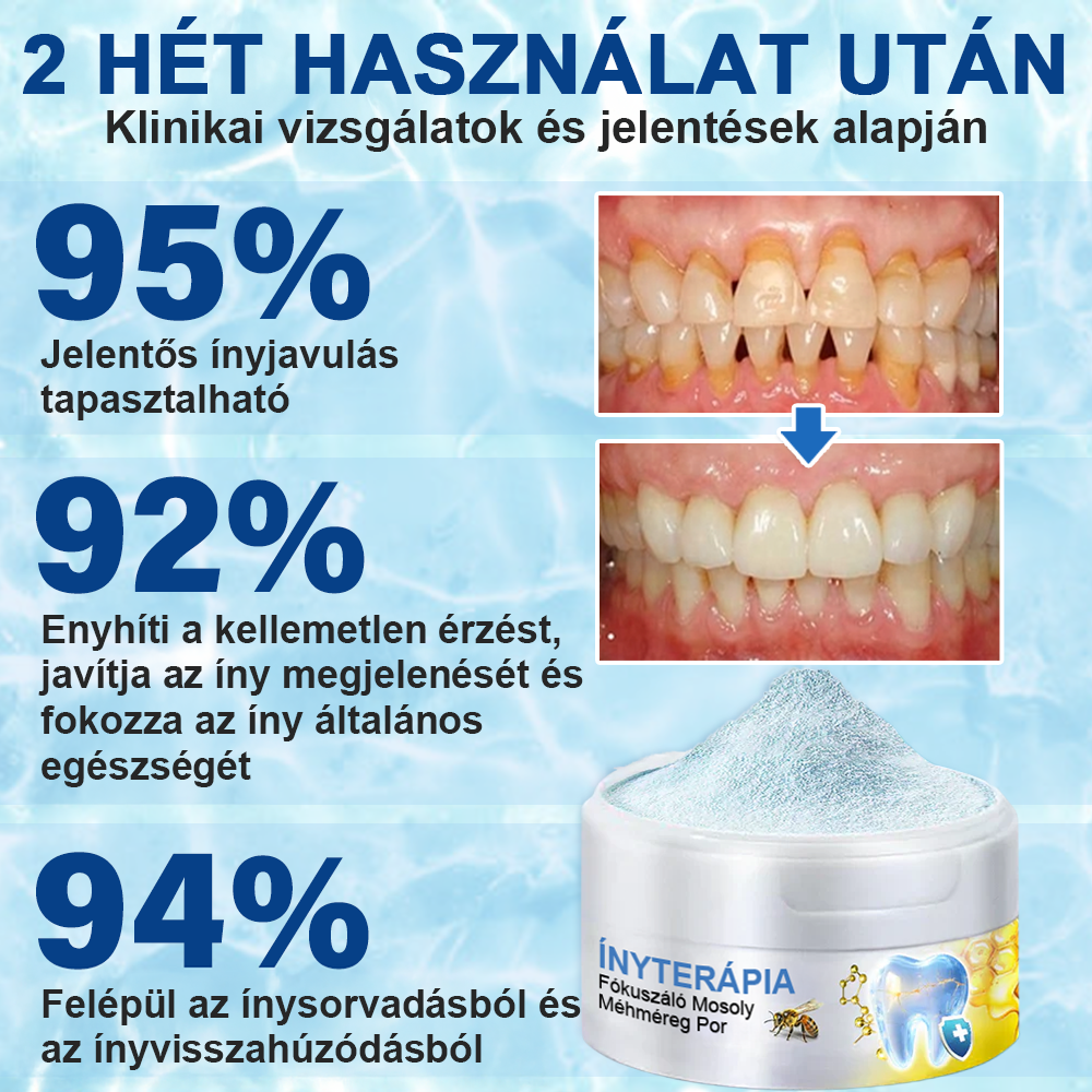 🇭🇺 Furzero® Focussmile – Méhméreges szájápoló por 🦷🦷