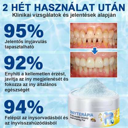 🇭🇺 Furzero® Focussmile – Méhméreges szájápoló por 🦷🦷