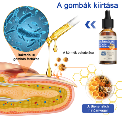 🐝Furzero™Méhméreg Körömgomba Kezelőoldat: Teljes megoldás a körömgomba problémájára🌟👣👣