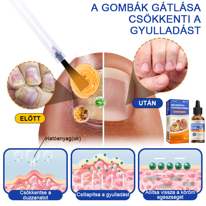 🐝Furzero™Méhméreg Körömgomba Kezelőoldat: Teljes megoldás a körömgomba problémájára🌟👣👣